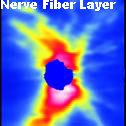 nerve fiber layer